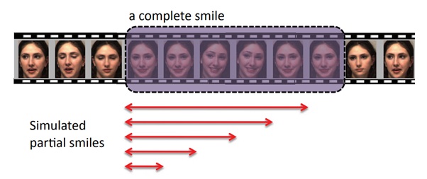 Stages of an incomplete smile